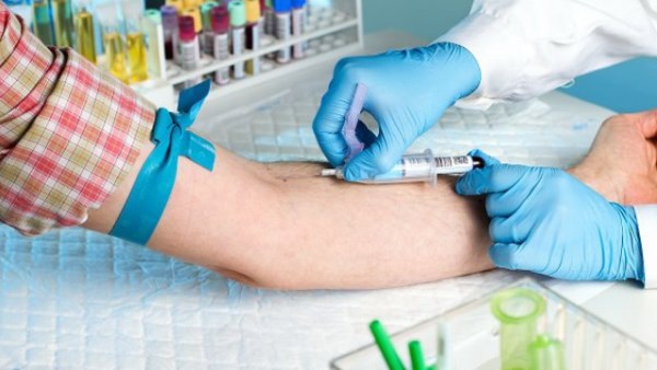 Xét nghiệm HIV bao lâu có kết quả 1 Xét nghiệm HIV bao lâu có kết quả 1