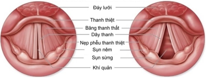 Kỹ thuật nội soi thanh quản ống mềm Kỹ thuật nội soi thanh quản ống mềm