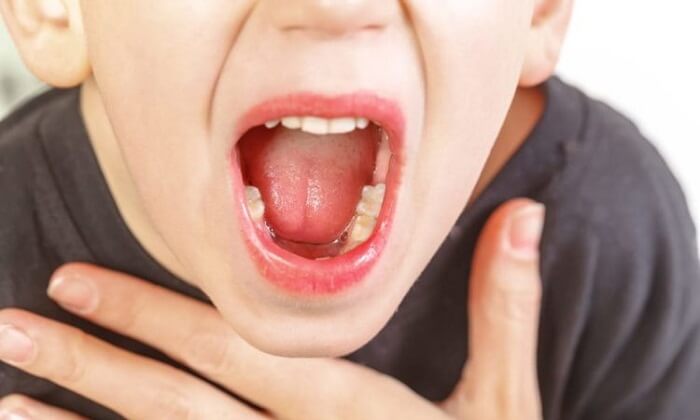 Trẻ em bị khàn tiếng Trẻ em bị khàn tiếng