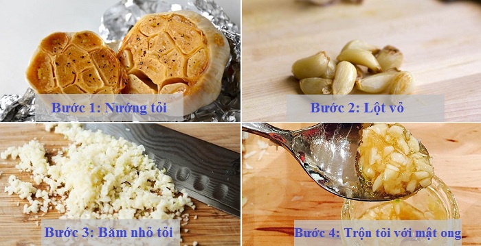 điều trị viêm họng ở trẻ em điều trị viêm họng ở trẻ em