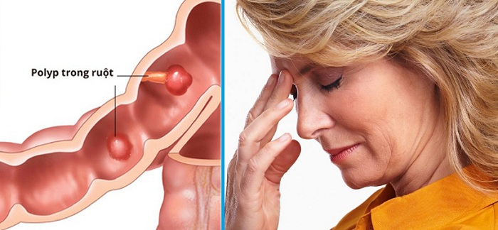 GÓI TẦM SOÁT UNG THƯ SỚM TOÀN DIỆN CHO NỮ -1 GÓI TẦM SOÁT UNG THƯ SỚM TOÀN DIỆN CHO NỮ -1