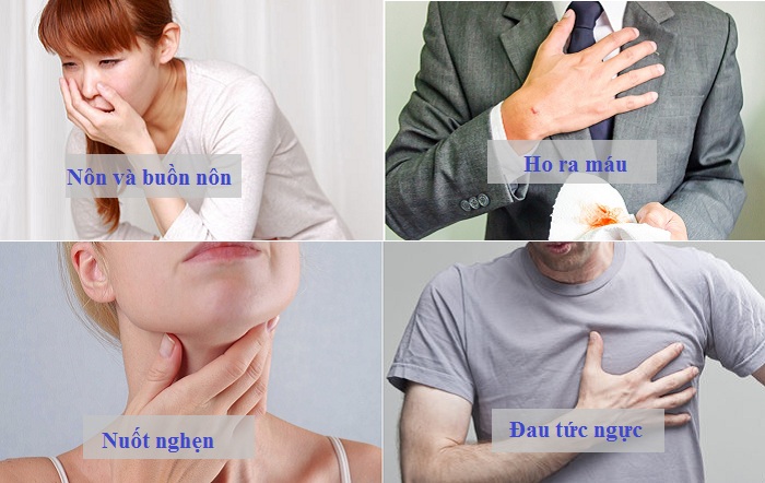 Cách phát hiện ung thư sớm -1 Cách phát hiện ung thư sớm -1