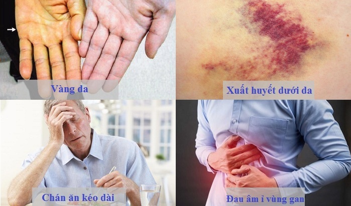 Tầm soát ung thư gan - Giải pháp phát hiện ung thư gan giai đoạn sớm -2 Tầm soát ung thư gan - Giải pháp phát hiện ung thư gan giai đoạn sớm -2