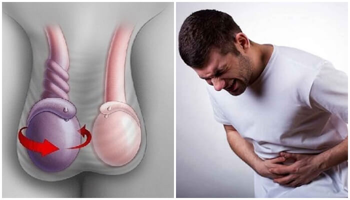 Đau bụng dưới bên trái Đau bụng dưới bên trái